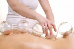 Cupping_Therapy2